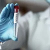 Ebola